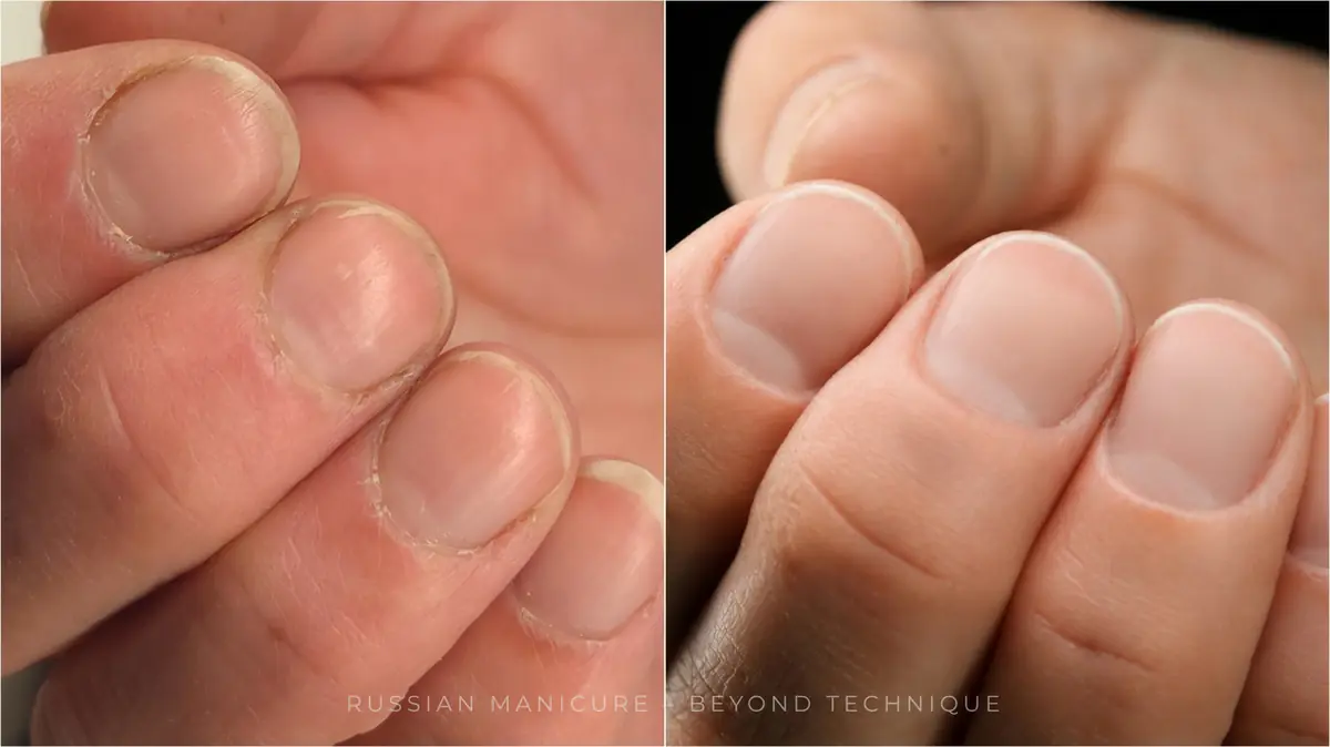 Two close-up photographs of fingers side by side, the left showing dry overgrown cuticles and the right showing smoother, cleaner cuticles after Russian Manicure, with the text Russian Manicure – Beyond Technique at the foot