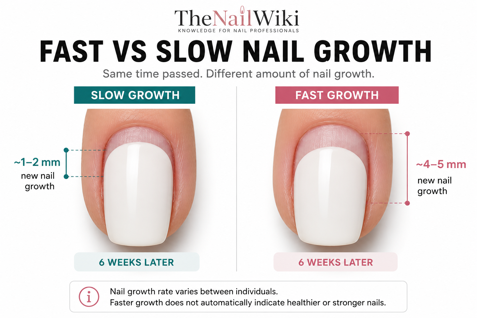 Comparison of slow and fast fingernail growth after six weeks, shown by different amounts of visible gel polish grow-out