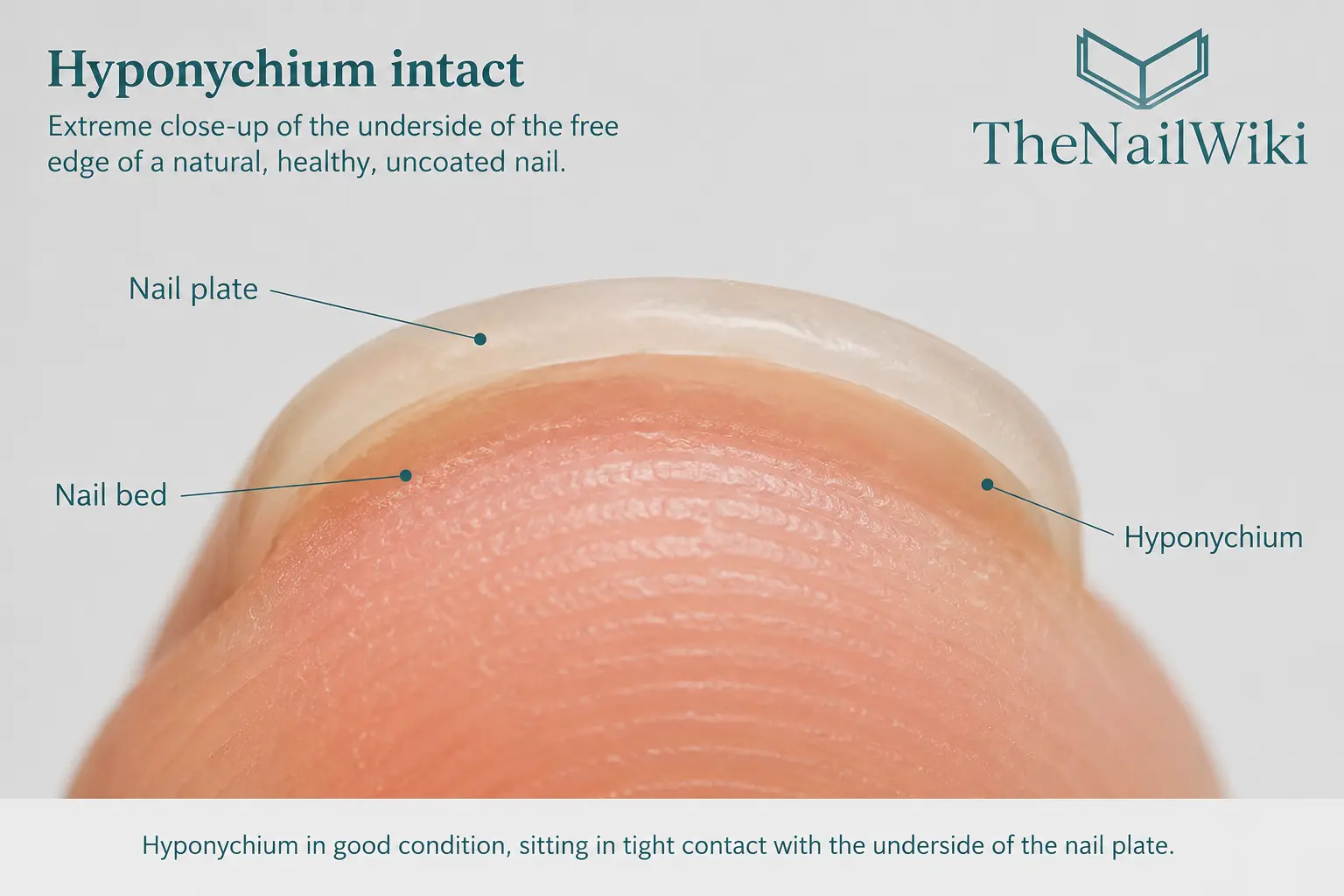 Close-up of the hyponychium — the thickened skin beneath the free edge of the nail plate sitting in tight contact with the underside of the nail plate at the distal nail unit