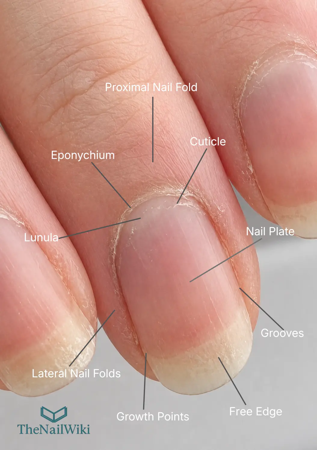 Real nail anatomy photograph with labels showing the proximal nail fold, eponychium, cuticle, lunula, nail plate, lateral nail folds, growth points, grooves, and free edge