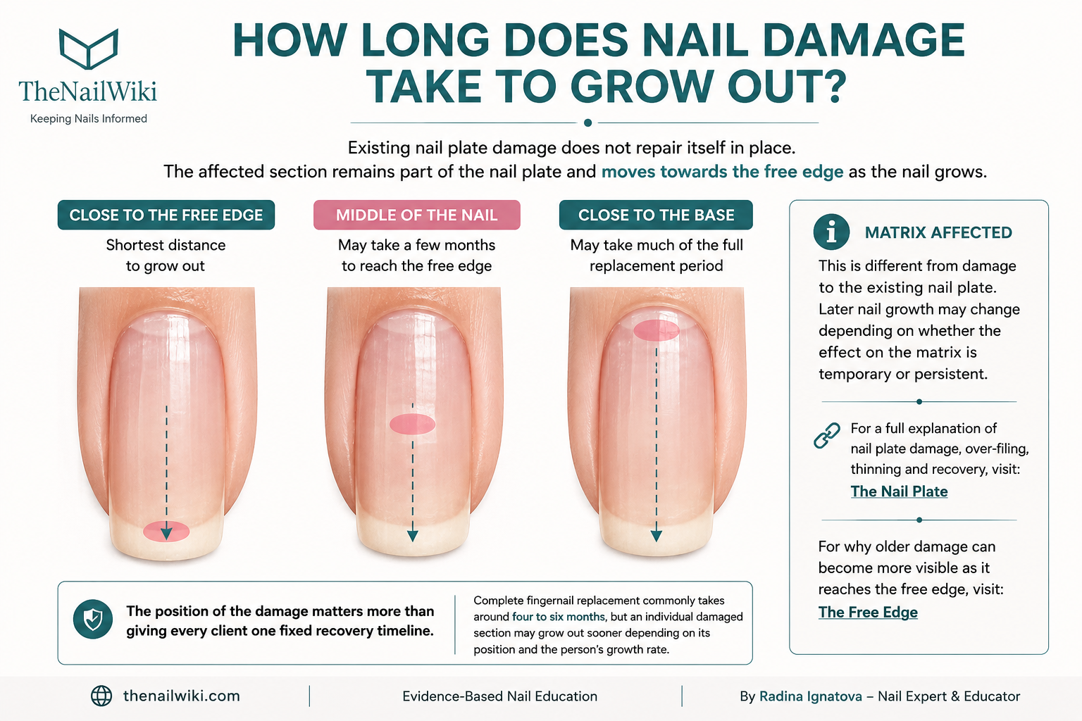 Infographic showing how the position of nail plate damage affects how long it takes to grow out