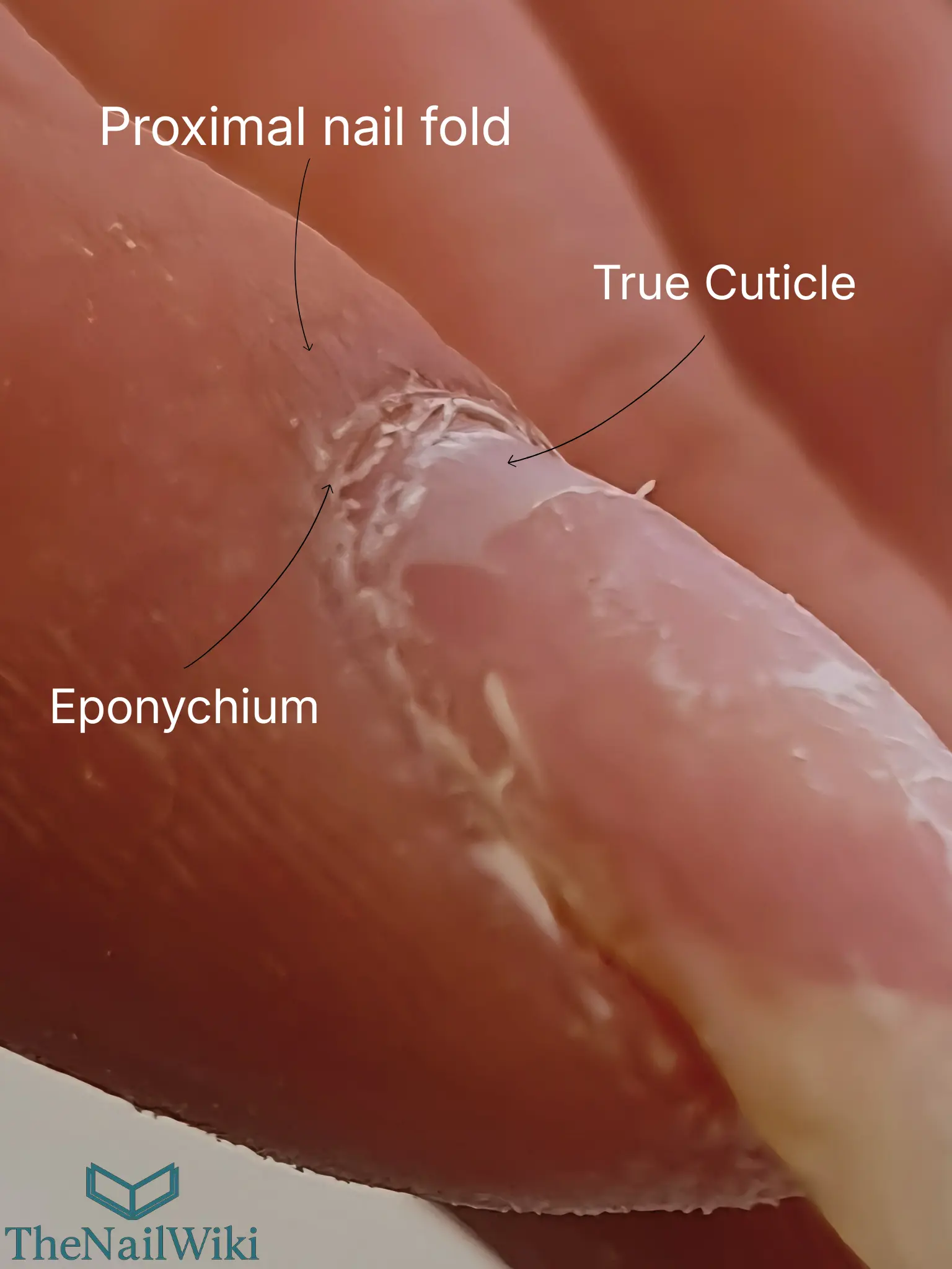 Close-up photograph of a fingernail base with labels identifying the proximal nail fold, eponychium, and true cuticle — showing the true cuticle as the thin translucent tissue adhered to the nail plate surface
