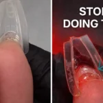 Professional demonstration comparing safe sandwich dual form placement technique with clean underside versus unsafe flooding method showing gel product pushed into hyponychium and lateral nail folds